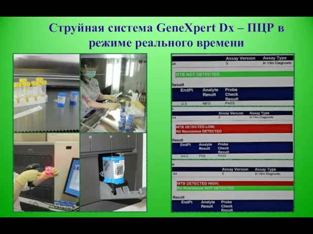 Струйная система GeneXpert Dx – ПЦР в режиме реального времени