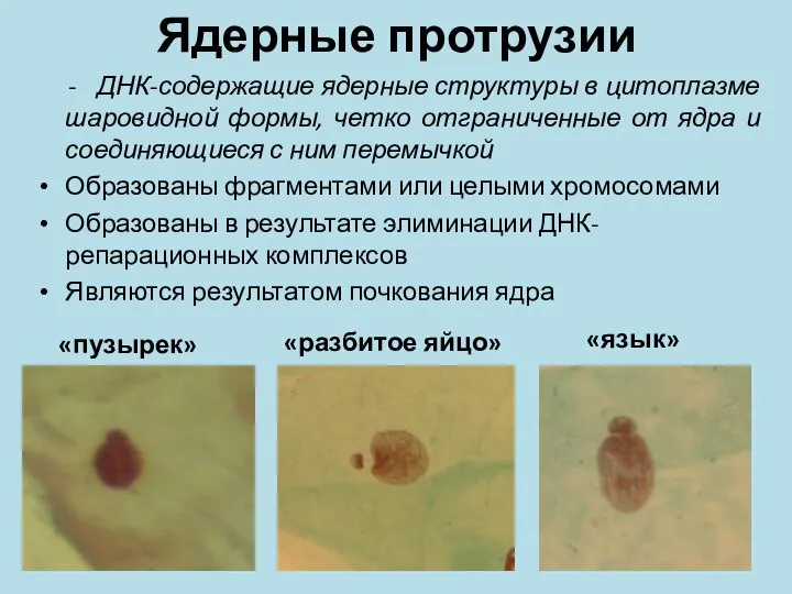 Ядерные протрузии - ДНК-содержащие ядерные структуры в цитоплазме шаровидной формы, четко