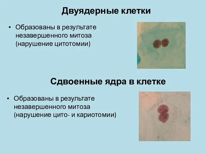 Сдвоенные ядра в клетке Образованы в результате незавершенного митоза (нарушение цитотомии)