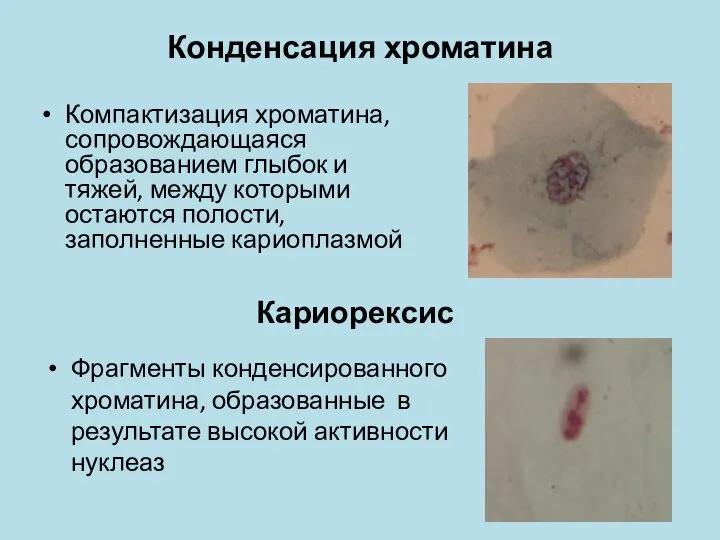 Конденсация хроматина Компактизация хроматина, сопровождающаяся образованием глыбок и тяжей, между которыми