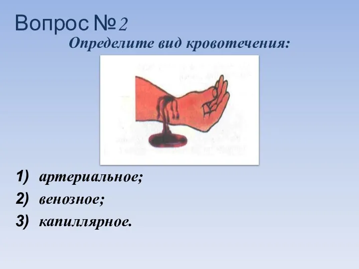 Вопрос №2 Определите вид кровотечения: артериальное; венозное; капиллярное.