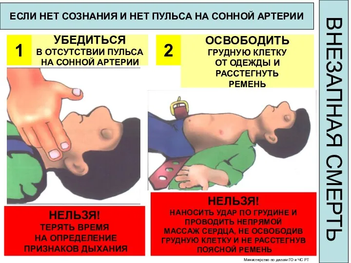 ЕСЛИ НЕТ СОЗНАНИЯ И НЕТ ПУЛЬСА НА СОННОЙ АРТЕРИИ 1 УБЕДИТЬСЯ