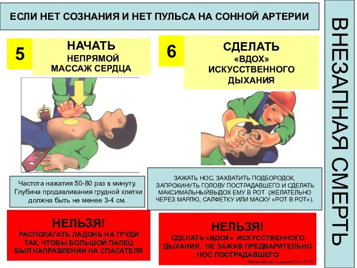 ЕСЛИ НЕТ СОЗНАНИЯ И НЕТ ПУЛЬСА НА СОННОЙ АРТЕРИИ 5 НАЧАТЬ