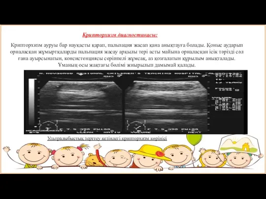 Крипторхизм ауруы бар науқасты қарап, пальпация жасап қана анықтауға болады. Қоныс