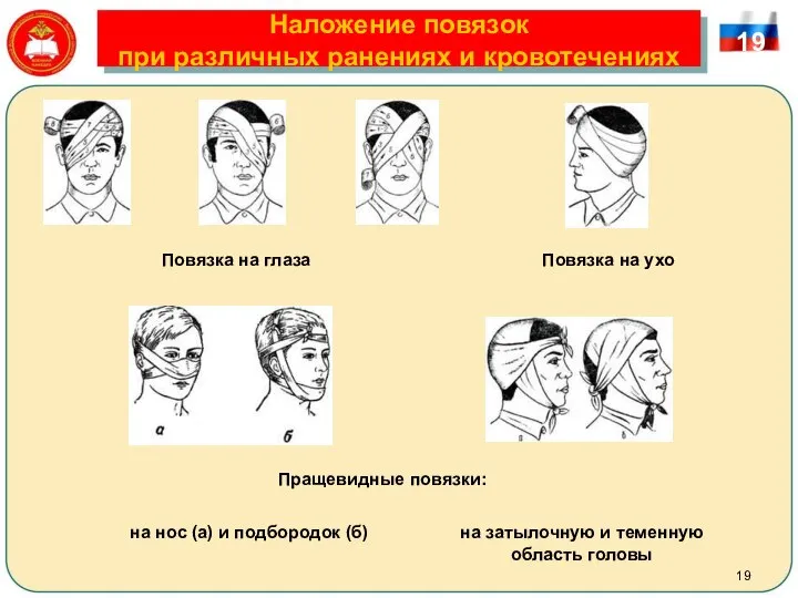 Наложение повязок при различных ранениях и кровотечениях 19 Повязка на глаза