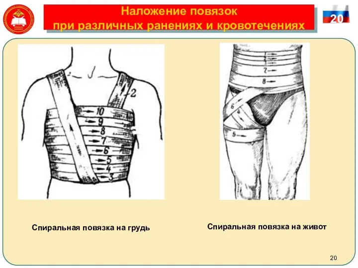 Наложение повязок при различных ранениях и кровотечениях 20 Спиральная повязка на грудь Спиральная повязка на живот