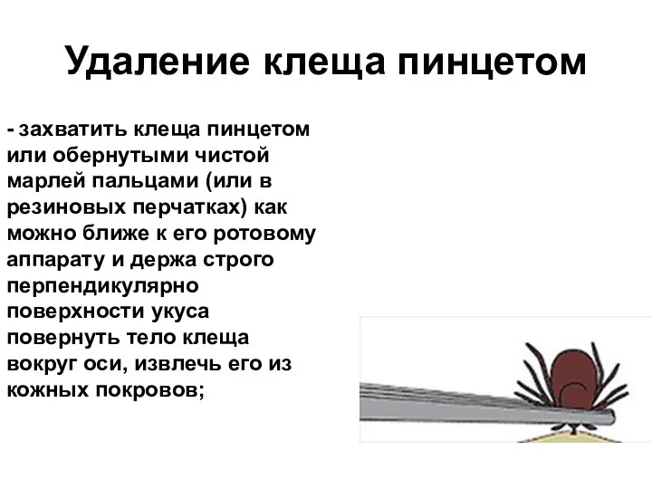 Удаление клеща пинцетом - захватить клеща пинцетом или обернутыми чистой марлей