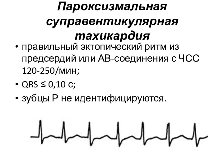 Пароксизмальная суправентикулярная тахикардия правильный эктопический ритм из предсердий или АВ-соединения с