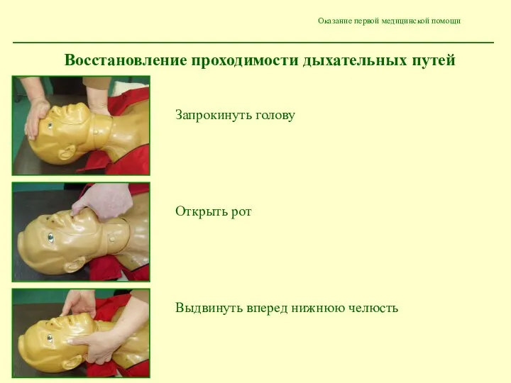 Оказание первой медицинской помощи Восстановление проходимости дыхательных путей Запрокинуть голову Открыть рот Выдвинуть вперед нижнюю челюсть