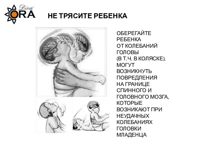 НЕ ТРЯСИТЕ РЕБЕНКА ОБЕРЕГАЙТЕ РЕБЕНКА ОТ КОЛЕБАНИЙ ГОЛОВЫ (В Т.Ч. В