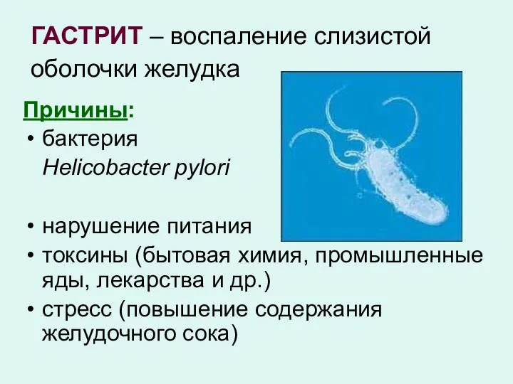 ГАСТРИТ – воспаление слизистой оболочки желудка Причины: бактерия Helicobacter pylori нарушение