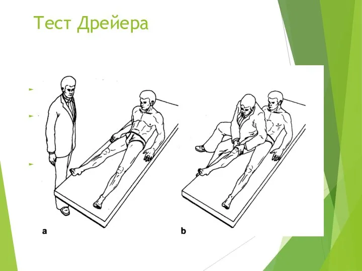 Тест Дрейера Предназначен для диагностики отрыва сухожилия четырёхглавой мышцы от верхнего