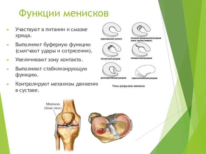 Функции менисков Участвуют в питании и смазке хряща. Выполняют буферную функцию(смягчают