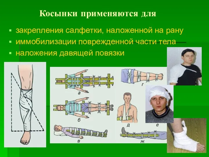 Косынки применяются для закрепления салфетки, наложенной на рану иммобилизации поврежденной части тела наложения давящей повязки