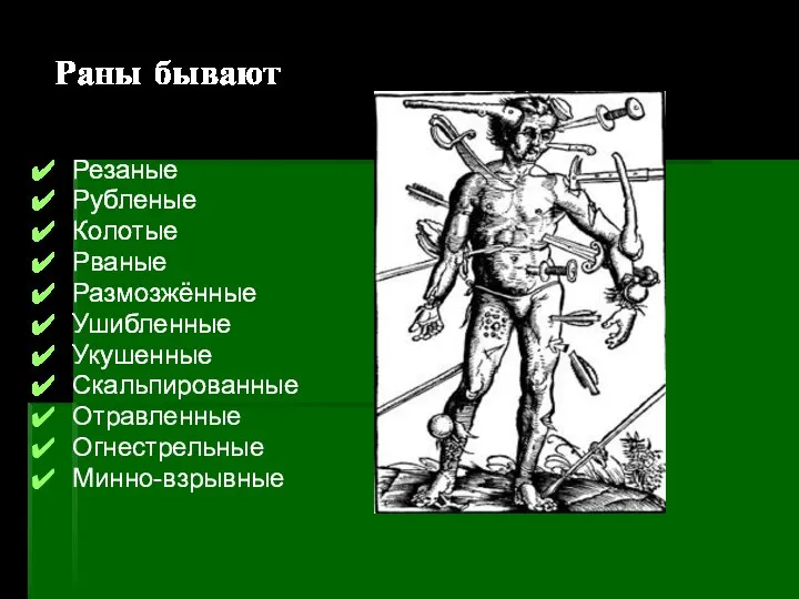 Раны бывают Резаные Рубленые Колотые Рваные Размозжённые Ушибленные Укушенные Скальпированные Отравленные Огнестрельные Минно-взрывные