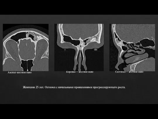 Аксиал-костное окно Саггитал – костное окно Коронал – костное окно Женщина