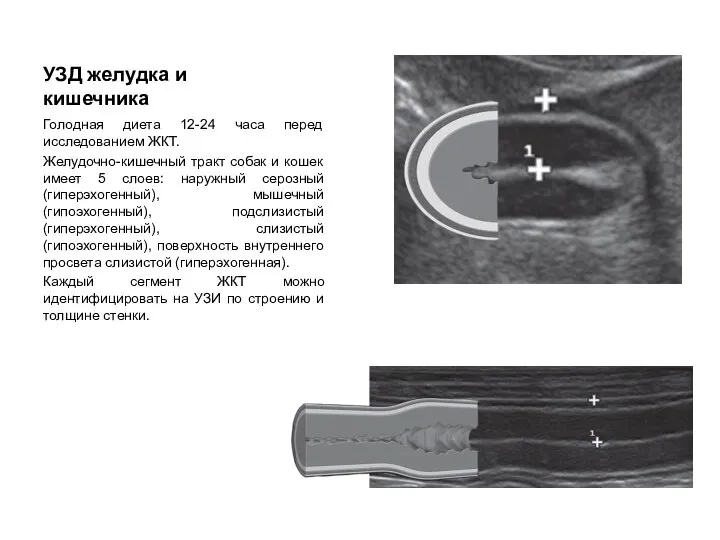 УЗД желудка и кишечника Голодная диета 12-24 часа перед исследованием ЖКТ.