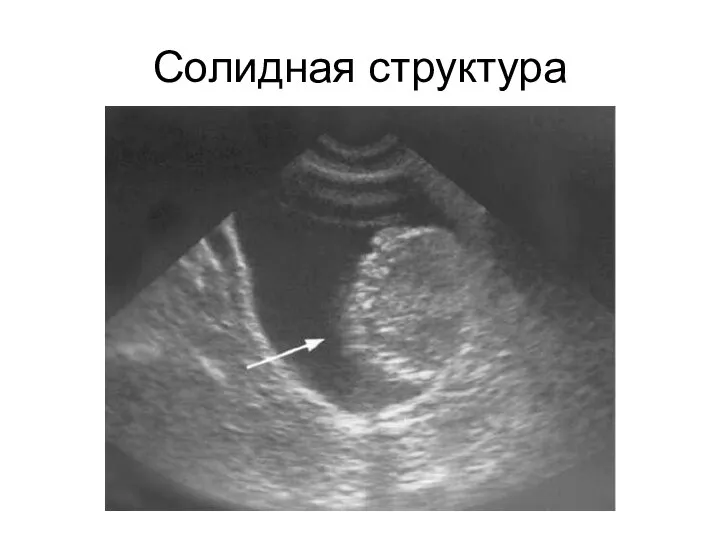 Солидная структура