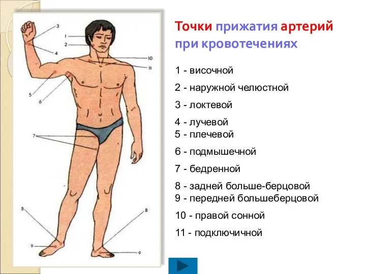 Точки прижатия артерий при кровотечениях 1 - височной 2 - наружной