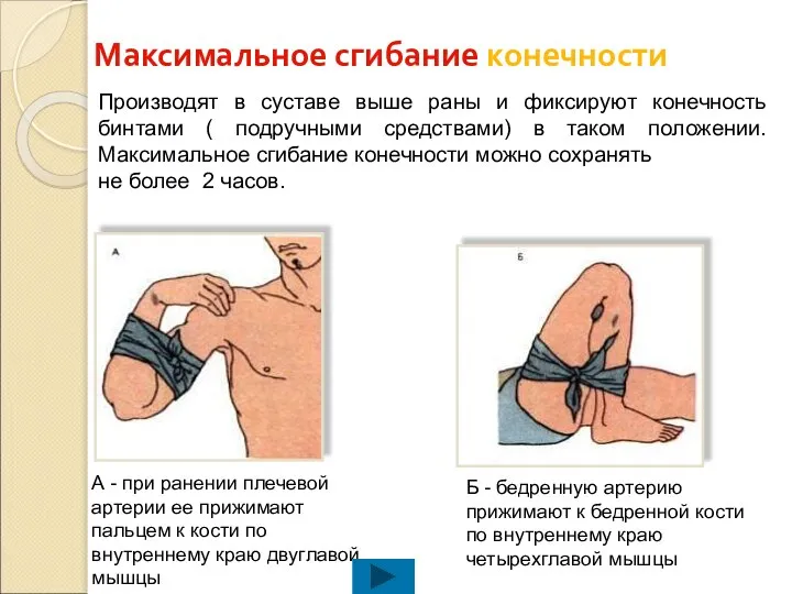 Максимальное сгибание конечности Производят в суставе выше раны и фиксируют конечность