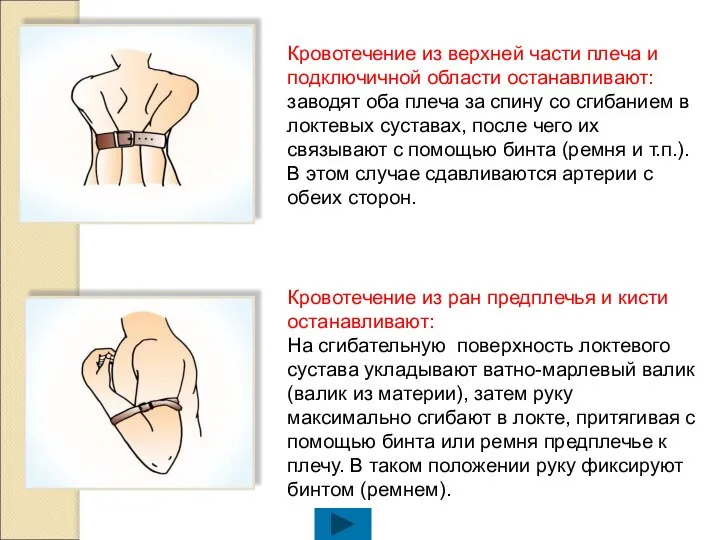 Кровотечение из верхней части плеча и подключичной области останавливают: заводят оба