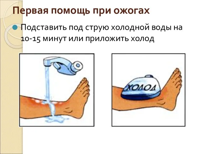 Первая помощь при ожогах Подставить под струю холодной воды на 10-15 минут или приложить холод