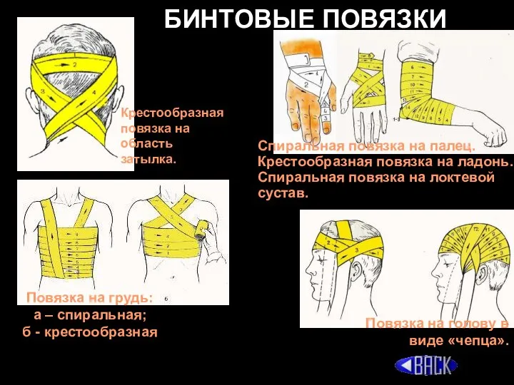 БИНТОВЫЕ ПОВЯЗКИ Спиральная повязка на палец. Крестообразная повязка на ладонь. Спиральная