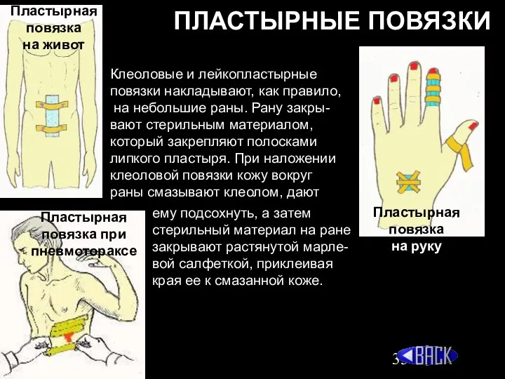 ПЛАСТЫРНЫЕ ПОВЯЗКИ Пластырная повязка при пневмотораксе Пластырная повязка на живот Пластырная