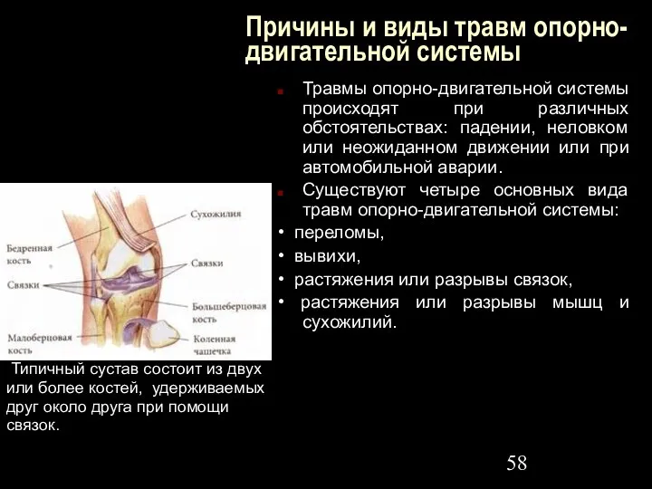 Причины и виды травм опорно-двигательной системы Травмы опорно-двигательной системы происходят при