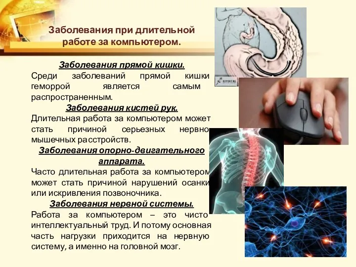 Заболевания при длительной работе за компьютером. Заболевания прямой кишки. Среди заболеваний