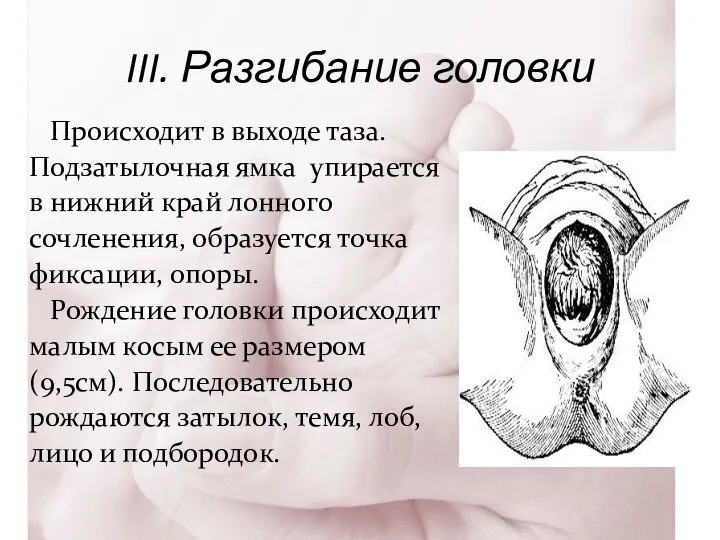 III. Разгибание головки Происходит в выходе таза. Подзатылочная ямка упирается в