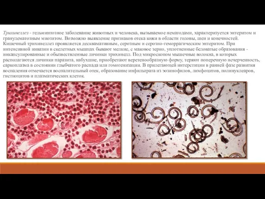Трихинеллез - гельминтозное заболевание животных и человека, вызываемое нематодами, характеризуется энтеритом