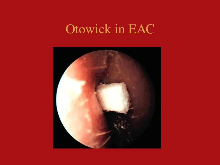 Otowick in EAC