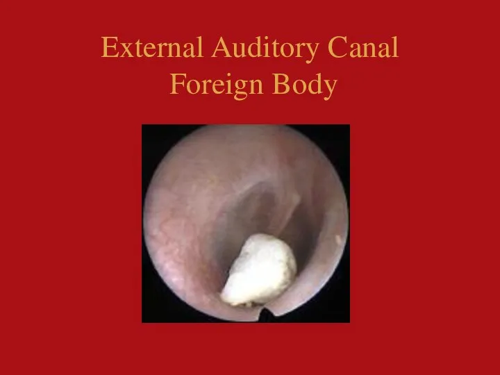 External Auditory Canal Foreign Body