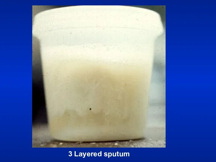 3 Layered sputum