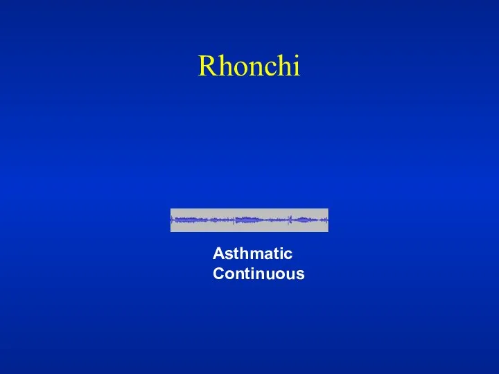 Rhonchi Asthmatic Continuous