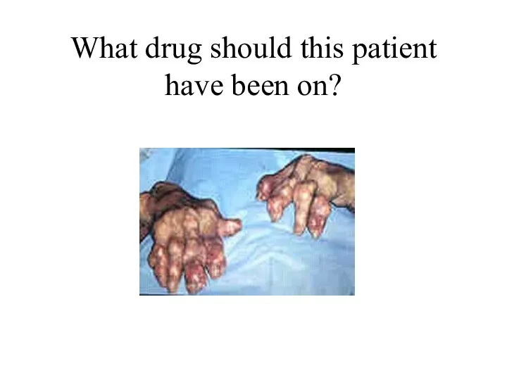 What drug should this patient have been on?