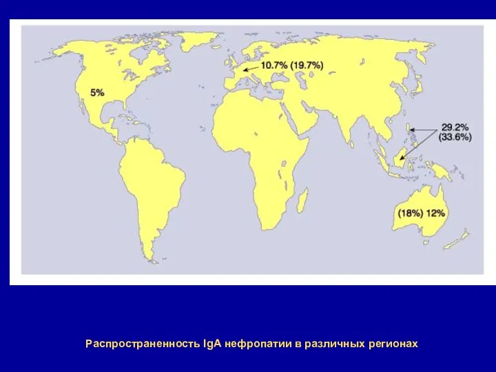 Распространенность IgА нефропатии в различных регионах
