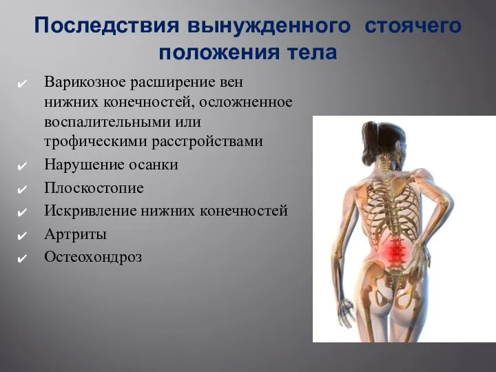 Последствия вынужденного стоячего положения тела Варикозное расширение вен нижних конечностей, осложненное