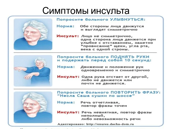 Симптомы инсульта