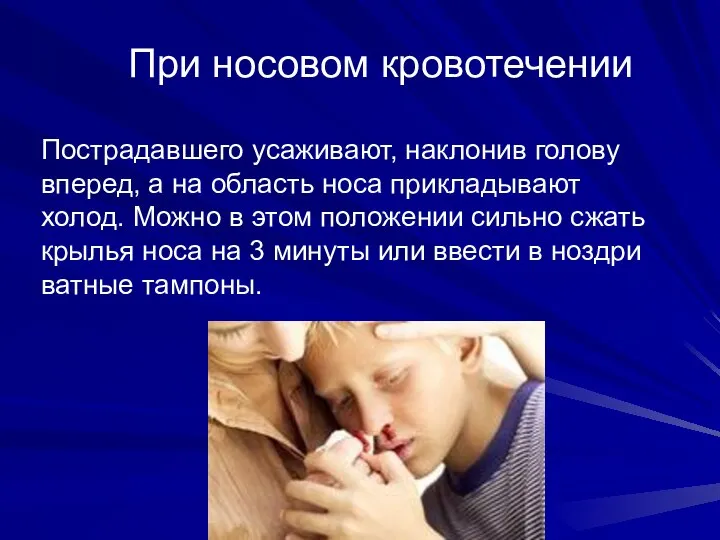 При носовом кровотечении Пострадавшего усаживают, наклонив голову вперед, а на область