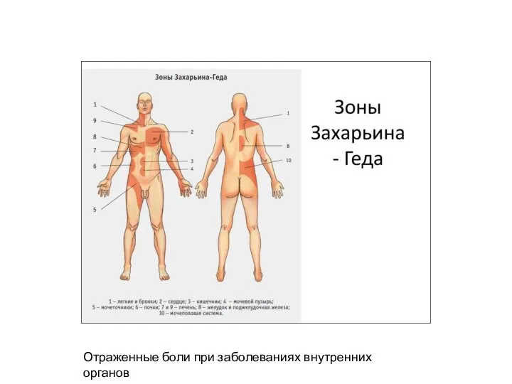 Отраженные боли при заболеваниях внутренних органов