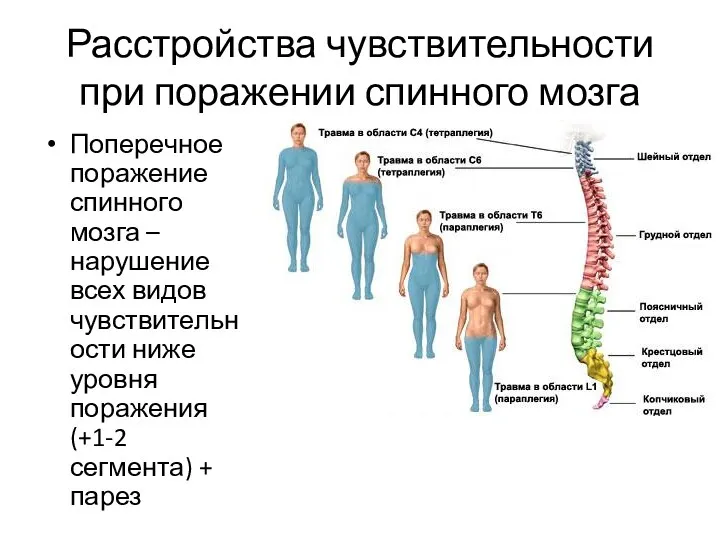 Расстройства чувствительности при поражении спинного мозга Поперечное поражение спинного мозга –