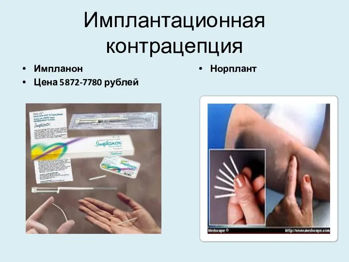 Имплантационная контрацепция Импланон Цена 5872-7780 рублей Норплант