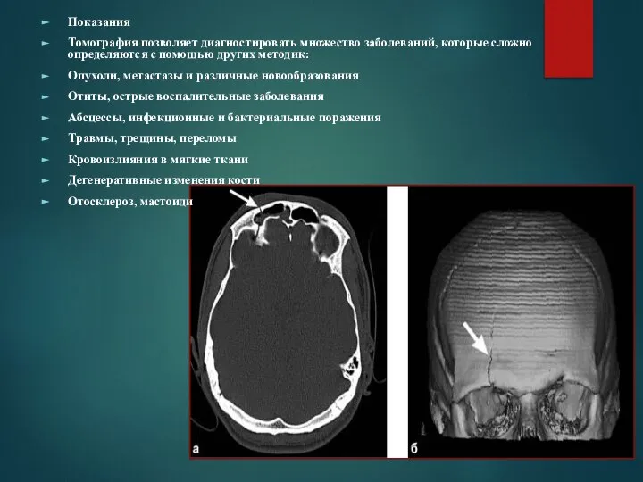 Показания Томография позволяет диагностировать множество заболеваний, которые сложно определяются с помощью