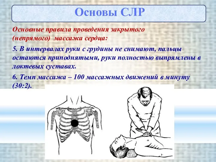 Основные правила проведения закрытого (непрямого) массажа сердца: 5. В интервалах руки