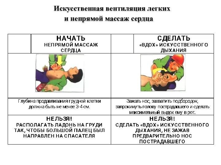 Искусственная вентиляция легких и непрямой массаж сердца