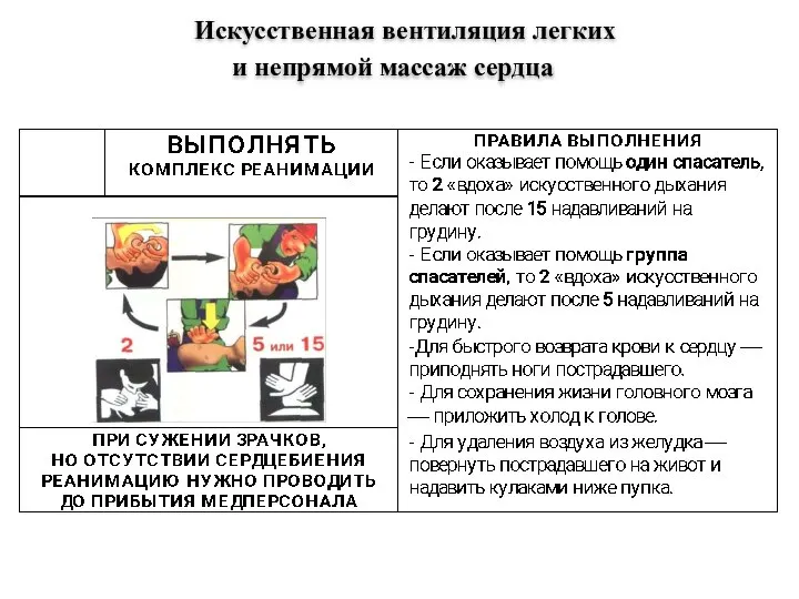 Искусственная вентиляция легких и непрямой массаж сердца