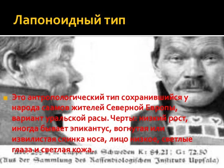 Лапоноидный тип Это антропологический тип сохранившийся у народа саамов жителей Северной