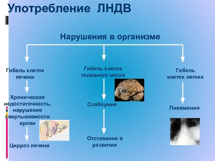 Употребление ЛНДВ Гибель клеток печени Хроническая недостаточность, нарушение свертываемости крови Цирроз